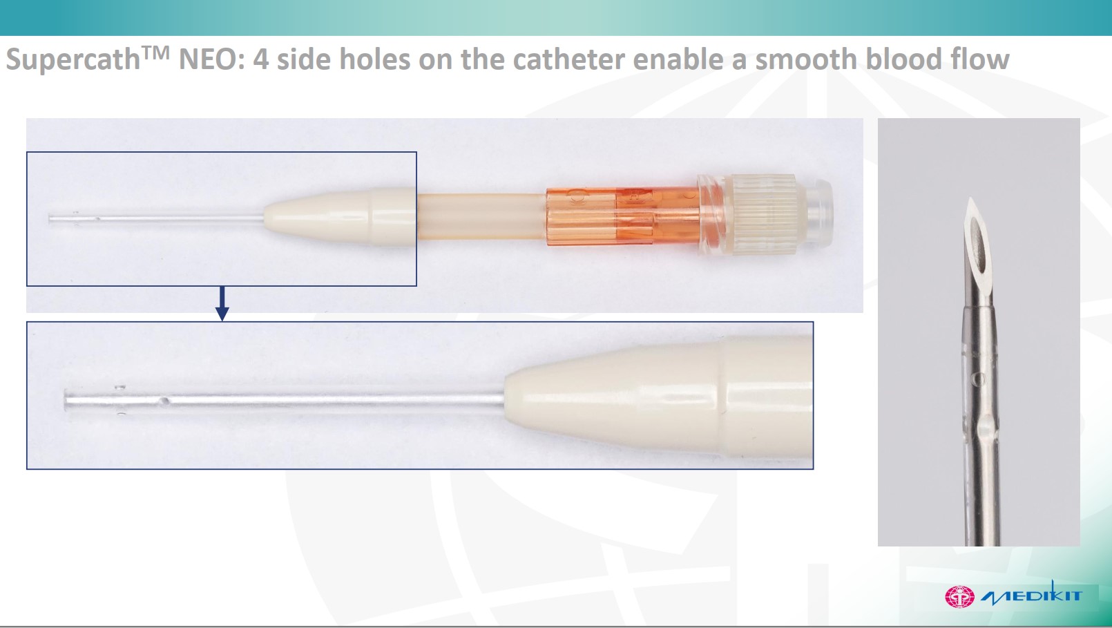 NEO4sideports